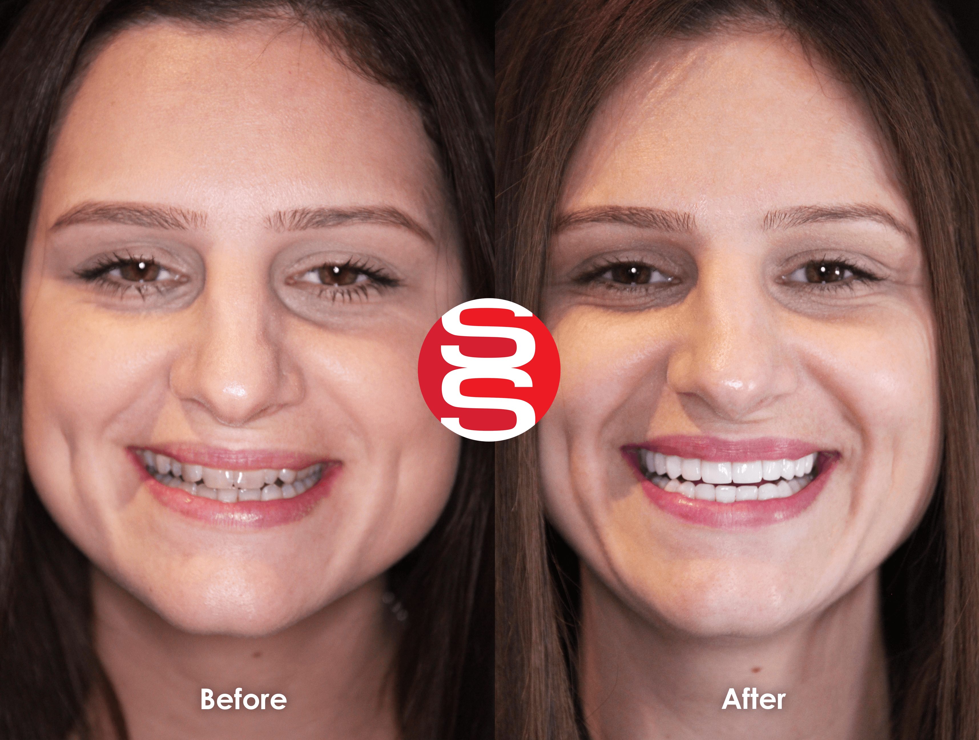 Margaret Before After